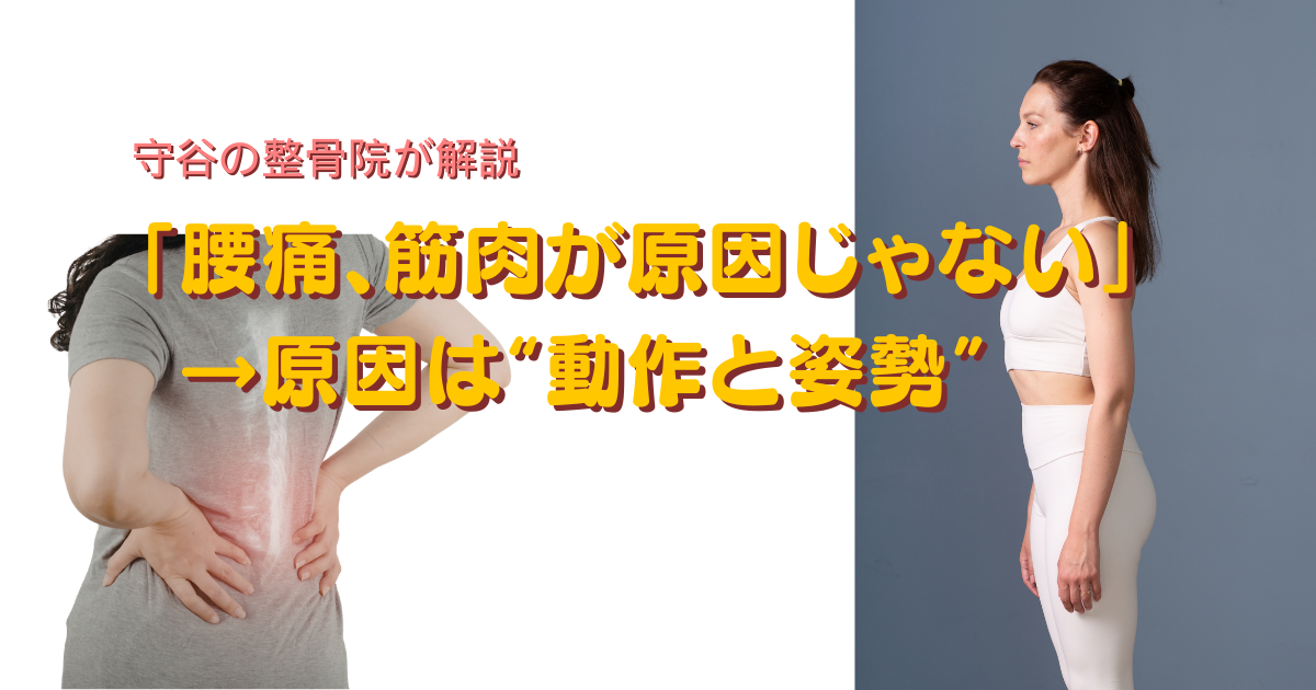 腰痛の原因が動作であることを示す画像