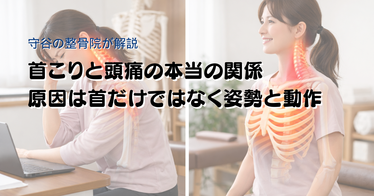 首こりと頭痛の関係を姿勢と動作の視点で示した画像