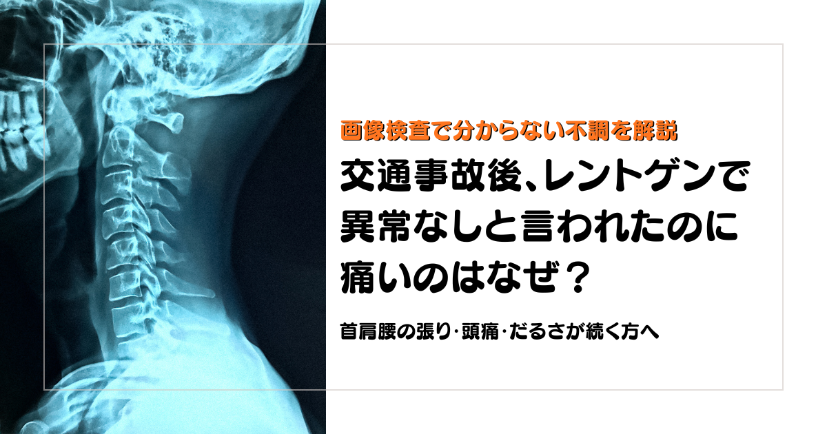 交通事故後にレントゲンで異常なしと言われたのに痛い理由を解説する守谷やまゆり鍼灸整骨院のブログアイキャッチ画像